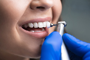 Beratungsgespräch zur Zahnbehandlung in der Praxis Dr. Becker in Grainau